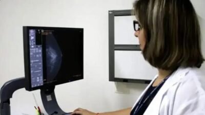 Novas descobertas sobre variações da proteína HER2 no câncer de mama